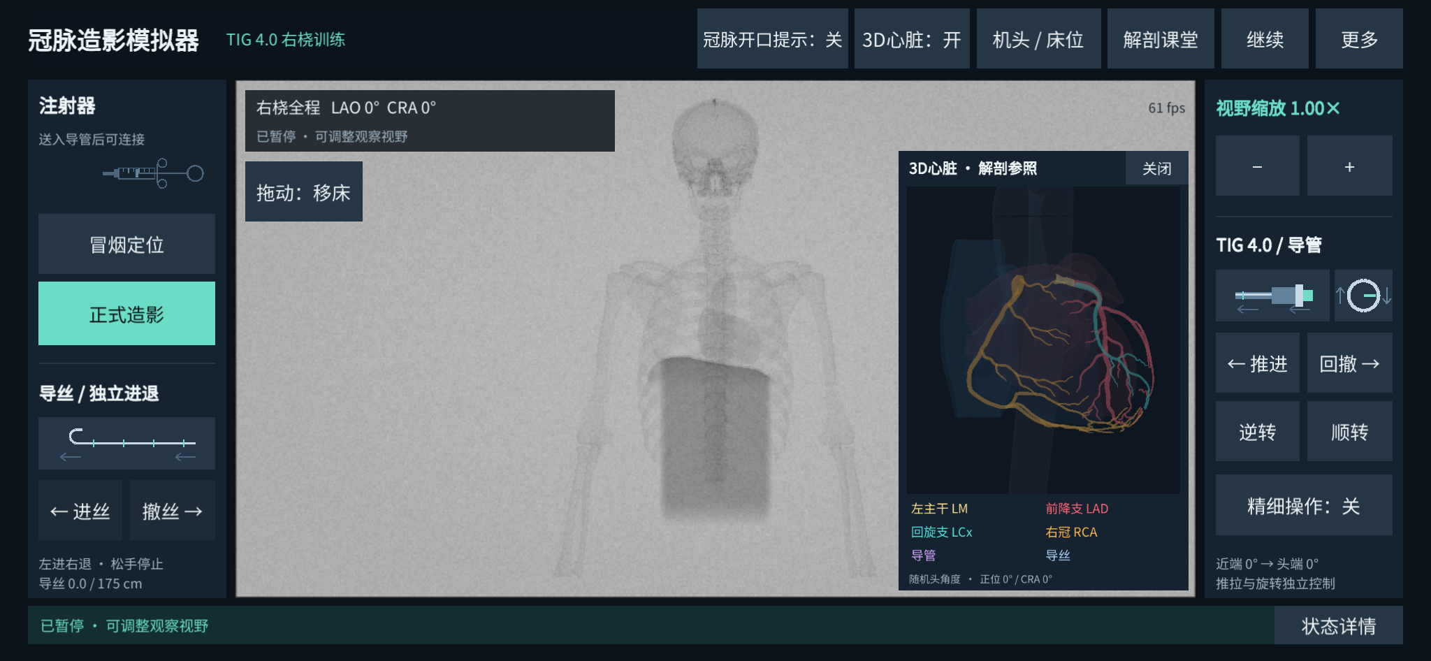 开发版界面:模拟造影视窗、器械控制与三维心脏参考